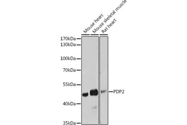 PDP2 antibody  (AA 67-250)
