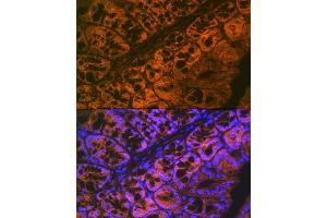 Immunofluorescence analysis of mouse large intestine using  Rabbit mAb (ABIN7265434) at dilution of 1:100 (40x lens). (ADAM15 antibody)
