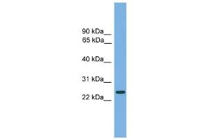 WB Suggested Anti-CHMP4B Antibody Titration: 0. (CHMP4B antibody  (Middle Region))