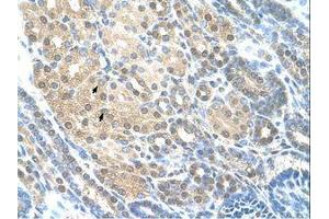 Image no. 1 for anti-RAD23 Homolog A (RAD23A) (AA 201-250) antibody (ABIN203508) (RAD23A antibody  (AA 201-250))