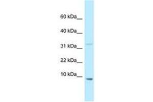 Image no. 1 for anti-High Mobility Group Nucleosomal Binding Domain 2 (HMGN2) (N-Term) antibody (ABIN6747931) (HMGN2 antibody  (N-Term))