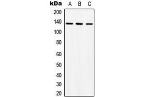 Western blot analysis of ABL1 expression in K562 (A), mouse liver (B), rat liver (C) whole cell lysates. (ABL1 antibody  (C-Term))