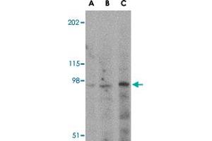 Western blot analysis of GRIK5 in human brain tissue lysate with GRIK5 polyclonal antibody  at (A) 0. (GRIK5 antibody  (C-Term))