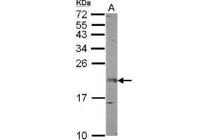 WB Image Sample (50 ug of whole cell lysate) A: mouse brain 12% SDS PAGE antibody diluted at 1:1000 (FGF12 antibody)