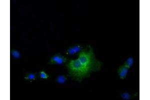 Anti-TBXAS1 mouse monoclonal antibody (ABIN2453710) immunofluorescent staining of COS7 cells transiently transfected by pCMV6-ENTRY TBXAS1 (RC208028). (TBXAS1 antibody)
