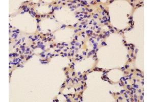 Formalin-fixed and paraffin embedded mouse lung labeled with Rabbit Anti-Fox2/RBM9 Polyclonal Antibody, Unconjugated  at 1:200 followed by conjugation to the secondary antibody and DAB staining (RBM9 antibody  (AA 65-170))