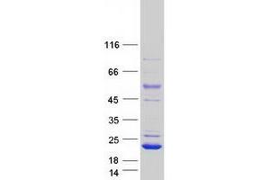 HRAS-Like Suppressor 3 (PLA2G16) (Transcript Variant 1) protein (Myc-DYKDDDDK Tag)