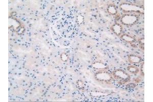 IHC-P analysis of Human Kidney Tissue, with DAB staining. (TLR3 antibody  (AA 404-532))