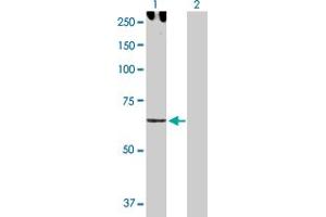 Western Blot analysis of CDH6 expression in transfected 293T cell line by CDH6 MaxPab polyclonal antibody. (CDH6 antibody  (AA 1-663))