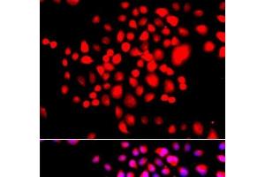 Immunofluorescence analysis of A549 cells using STK19 Polyclonal Antibody (STK19 antibody)