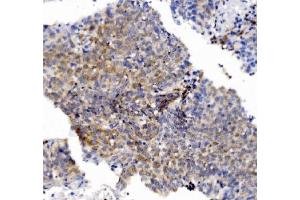 IHC analysis of CHCHD10 using anti-CHCHD10 antibody (ABIN7602507). (CHCHD10 antibody  (AA 80-142))