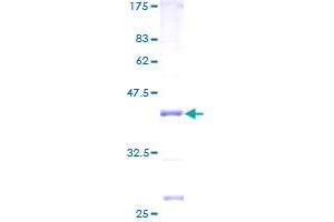 Image no. 1 for Mitochondrial Ribosomal Protein L51 (MRPL51) (AA 1-128) protein (GST tag) (ABIN1311346) (MRPL51 Protein (AA 1-128) (GST tag))