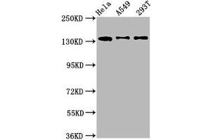 Western Blot Positive WB detected in: Hela whole cell lysate, A549 whole cell lysate, 293T whole cell lysate All lanes: MAN2B2 antibody at 1. (MAN2B2 antibody  (AA 347-523))