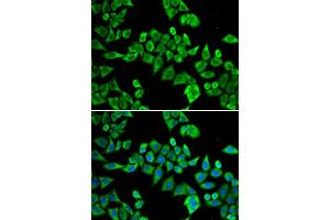 Immunofluorescence analysis of HeLa cells using DDX20 antibody (ABIN6130250, ABIN6139482, ABIN6139483 and ABIN6221507). (DDX20 antibody  (AA 25-280))