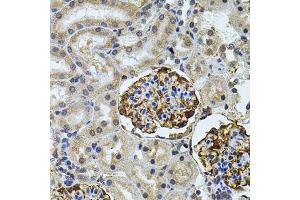 Immunohistochemistry of paraffin-embedded rat kidney using CETP antibody (ABIN5970634) (40x lens). (CETP antibody)