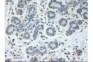 Immunohistochemical staining of paraffin-embedded breast tissue using anti-USP13 mouse monoclonal antibody.