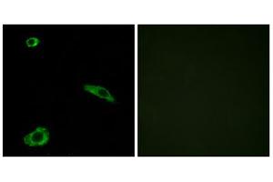 Immunofluorescence analysis of MCF-7 cells, using ACTHR antibody. (MC2R antibody  (C-Term))
