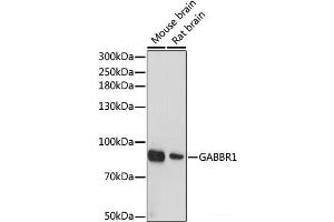 Western blot analysis of extracts of various cell lines using GABBR1 Polyclonal Antibody at dilution of 1:1000. (GABBR1 antibody)