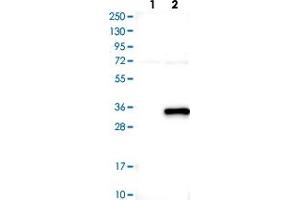 Western blot analysis of Lane 1: Negative control (vector only transfected HEK293T lysate) Lane 2: Over-expression lysate (Co-expressed with a C-terminal myc-DDK tag (~3. (ABHD12B antibody)