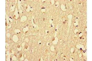 Immunohistochemistry of paraffin-embedded human brain tissue using ABIN7160576 at dilution of 1:100 (MYH3 antibody  (AA 1-217))