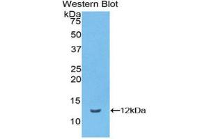 Western blot analysis of the recombinant protein. (Vitronectin antibody  (AA 19-111))