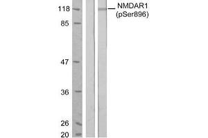 Western blot analysis of extract from MCF7 cells, untreated or treated with estradiol (100nM, 20min), using NMDAR1 (phospho-Ser896) antibody (E011104). (GRIN1/NMDAR1 antibody  (pSer896))