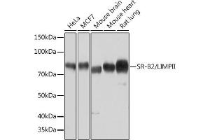 Western blot analysis of extracts of various cell lines, using SR-B2/SR-B2/LIMPII Rabbit mAb (ABIN7270157) at 1:1000 dilution.