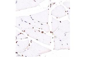 Immunohistochemistry of paraffin embedded rat Skeletal muscle using ZNF498 (ABIN7076253) at dilution of 1:4000 (400x lens) (Zinc Finger and SCAN Domain Containing 25 (ZSCAN25) antibody)