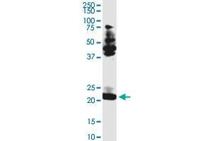 TCEAL3 monoclonal antibody (M05), clone 4F3. (TCEAL3 antibody  (AA 1-200))