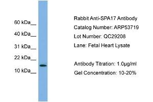 WB Suggested Anti-SPA17  Antibody Titration: 0. (SPA17 antibody  (N-Term))