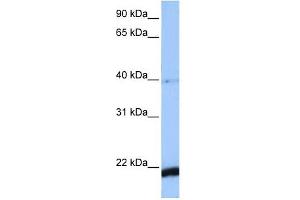 HBS1L antibody used at 1 ug/ml to detect target protein.
