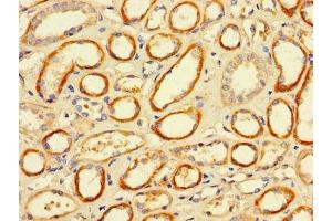 Immunohistochemistry (IHC) image for anti-Fc Fragment of IgG, Low Affinity IIa, Receptor (CD32) (FCGR2A) (AA 241-317) antibody (ABIN7158537)