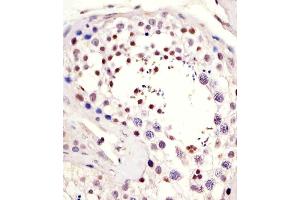 Antibody staining LIN28B in human testis tissue sections by Immunohistochemistry (IHC-P - paraformaldehyde-fixed, paraffin-embedded sections). (LIN28B antibody  (AA 95-128))