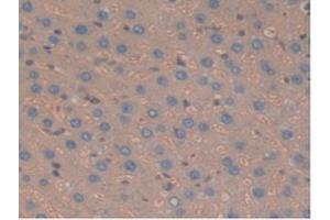 IHC-P analysis of Rat Liver Tissue, with DAB staining. (Haptoglobin antibody  (AA 70-332))