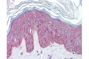 Immunohistochemistry (IHC) image for anti-Interleukin 33 (IL33) (N-Term) antibody (ABIN406152) (IL-33 antibody  (N-Term))