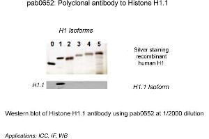 Image no. 1 for anti-Histone H1.1 (HIST1H1A) (N-Term) antibody (ABIN410162) (Histone H1.1 antibody  (N-Term))