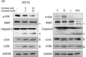 Western Blotting (WB) image for anti-Poly (ADP-Ribose) Polymerase 1 (PARP1) antibody (ABIN2854798)