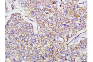 Immunohistochemistry (Paraffin-embedded Sections) (IHC (p)) image for anti-Cadherin 2 (CDH2) (AA 701-800) antibody (ABIN738726)