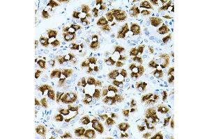 Immunohistochemistry of paraffin-embedded human stomach using DLK1 antibody. (DLK1 antibody  (AA 83-383))