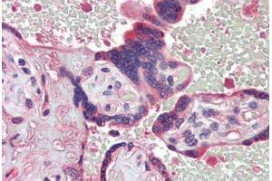 Human Placenta (formalin-fixed, paraffin-embedded) stained with  antibody ABIN462272 followed by biotinylated secondary antibody, alkaline phosphatase-streptavidin and chromogen. (TDP1 antibody  (AA 1-298))