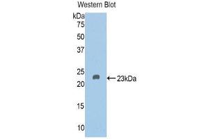 Western Blotting (WB) image for anti-Vitamin D-Binding Protein (GC) (AA 209-394) antibody (ABIN1858610) (Vitamin D-Binding Protein antibody  (AA 209-394))