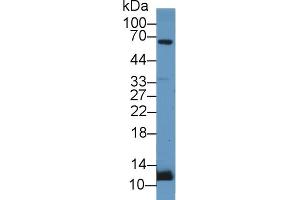 Detection of UCN2 in Rat Adrenal gland lysate using Polyclonal Antibody to Urocortin 2 (UCN2) (Urocortin 2 antibody  (AA 20-112))
