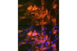 Immunofluorescence analysis of C6 cells using CRYAB Rabbit mAb (ABIN7266528) at dilution of 1:100 (40x lens). (CRYAB antibody)
