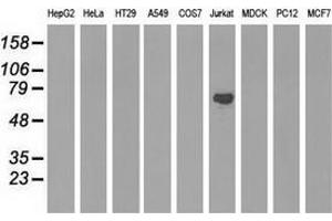 Western blot analysis of extracts (35 µg) from 9 different cell lines by using anti-ARHGAP25 monoclonal antibody. (ARHGAP25 antibody)