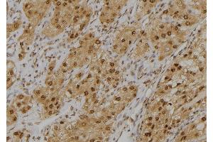 ABIN6276963 at 1/100 staining Human kidney tissue by IHC-P. (GLO1 antibody  (Internal Region))