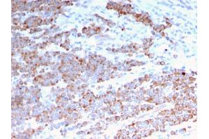 Immunohistochemistry (IHC) image for anti-Keratin 18 (KRT18) antibody (ABIN6939926)
