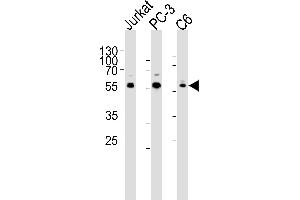 Western blot analysis of lysates from Jurkat, PC-3, C6 cell line (from left to right), using AKT1/2/3 Antibody (Center) (ABIN6244286 and ABIN6577440). (AKT 1/2/3 antibody  (AA 278-312))