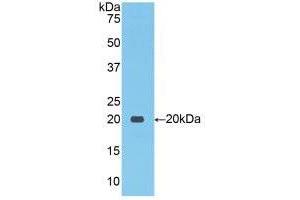 Western blot analysis of recombinant Human NCCT. (SLC12A3 antibody  (AA 867-1024))