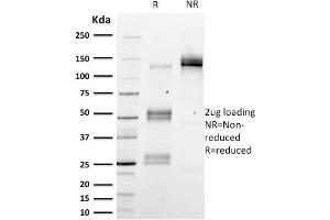 SDS-PAGE (SDS) image for anti-Emerin (EMD) (AA 56-167) antibody (ABIN6939303)