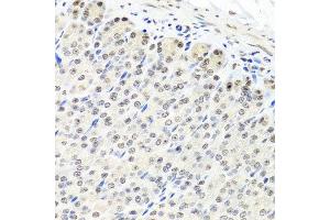 Immunohistochemistry of paraffin-embedded mouse stomach using CNOT8 antibody at dilution of 1:100 (x40 lens).